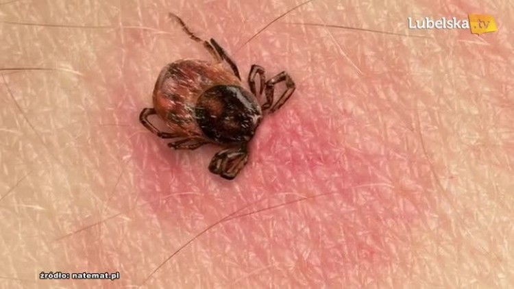 20170728_kleszcze_logo.mp4